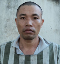 Đánh nghi can trộm chim chấn thương sọ não