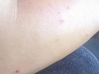 Côn trùng lạ tấn công người dân