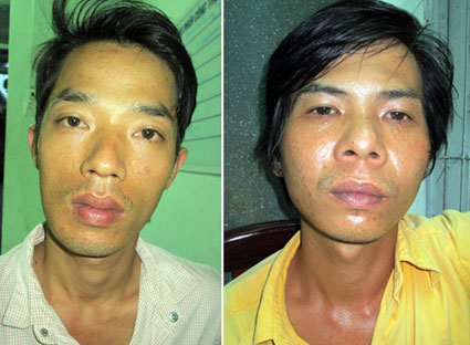 Dàn cảnh để giật dây chuyền của bạn nhậu