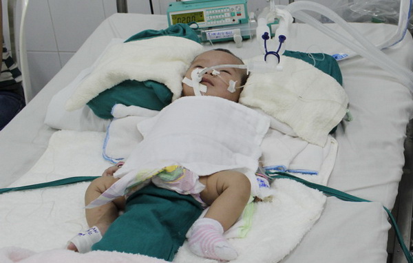 Bệnh nhi cần được giúp đỡ mổ tim