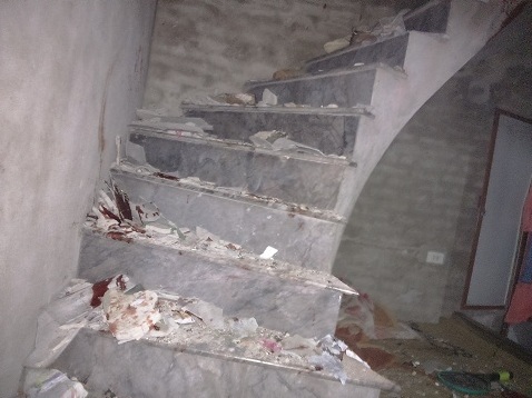 Thuốc pháo nổ lớn như bom, nam thanh niên nguy kịch