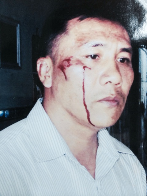 Ông Hoạt bị đánh với nhiều vết máu trên mặt
