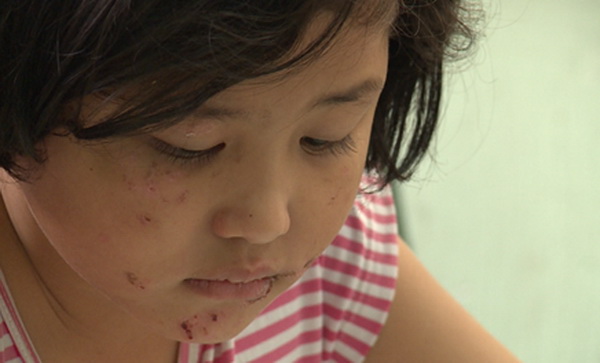 Xót xa khi cha dùng lửa… dạy con