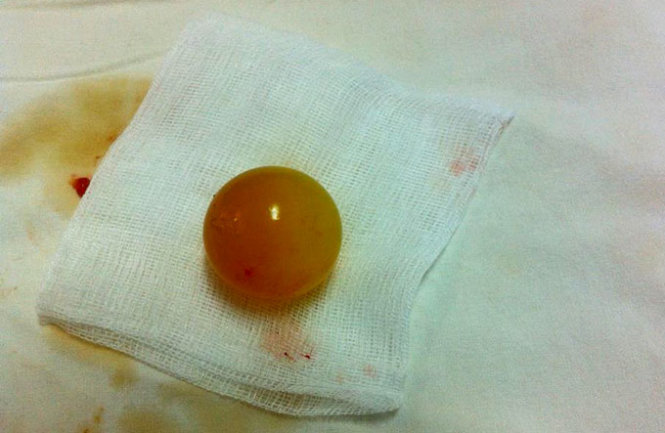 Nhập viện vì… đồ chơi Trung Quốc