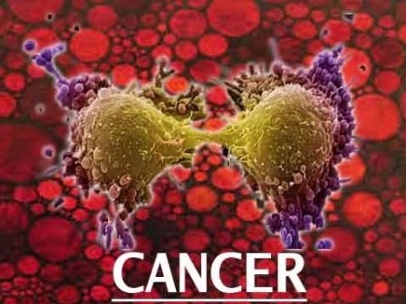 Tìm ra phương pháp xét nghiệm mới phát hiện sớm ung thư