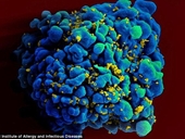 Vắc-xin phòng ngừa virus HIV đã nghiên cứu thành công
