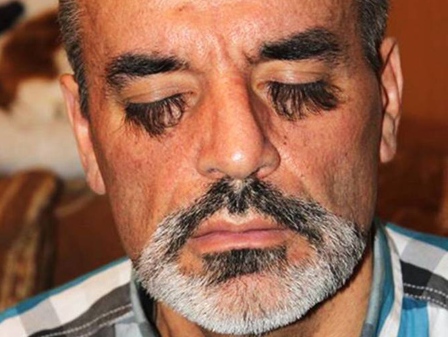 Người đàn ông có lông mi siêu dài