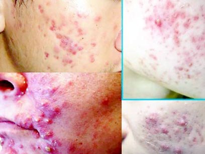 Nguy hại từ mỹ phẩm giả, kém chất lượng