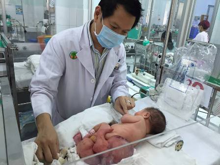 Bóc thành công u quái khổng lồ cho bé gái sơ sinh