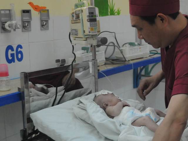 Cháu bé 10 ngày tuổi bị cắt 2 mét ruột