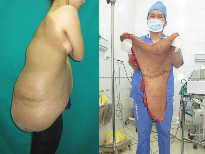 Những ca bệnh hi hữu khiến các bác sĩ phải nhớ mãi