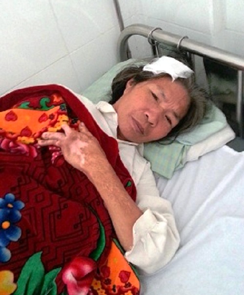 Bà Nguyễn Thị Khanh đang phải nằm tại bệnh viện Đa khoa Phố Nối sau vụ việc xô xát