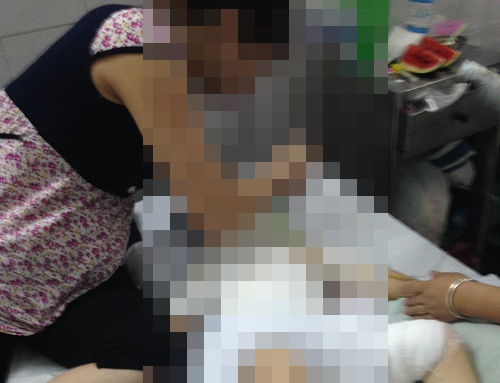 Tạm đình chỉ 2 cô giáo trong vụ bé gái mầm non bị bạn đốt bỏng