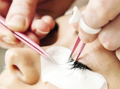 Cấy lông mi làm hại mắt
