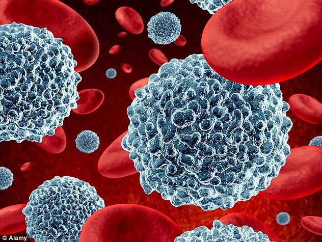 Phát hiện sát thủ của bệnh ung thư