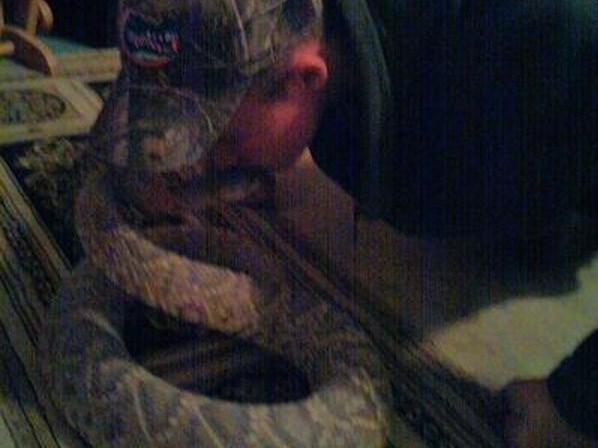 Chàng trai phải nhập viện vì sở thích hôn rắn vô cùng nguy hiểm