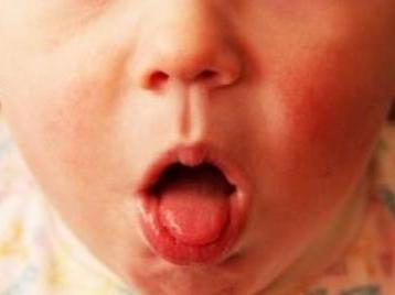 Bệnh ho gà có thể đe dọa tính mạng của trẻ