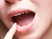 Màu sắc của lưỡi là dấu hiệu tiết lộ về sức khỏe của bạn