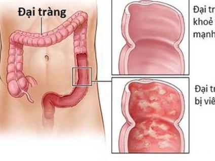Những dấu hiệu đau ở phụ nữ không được coi nhẹ