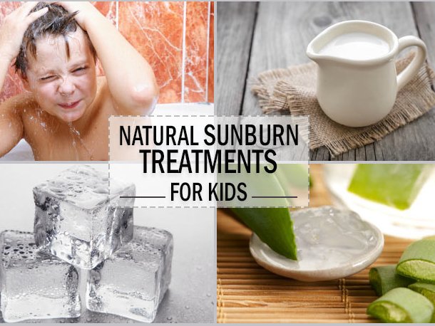 10 phương thuốc tự nhiên chữa bỏng nắng