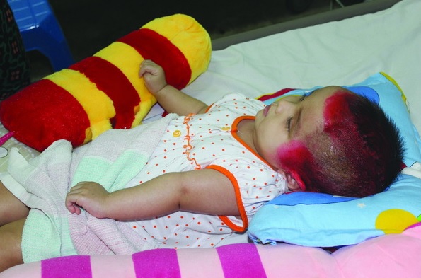 Đau lòng cháu bé 1 tuổi bị chấn thương sọ não