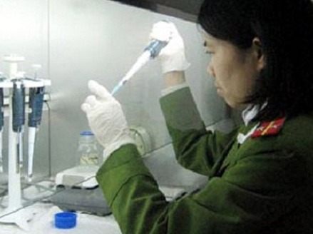 Chuyên gia pháp y tham gia phá án Kỳ 10  Bí ẩn sau những dấu chấm lạ trên cổ nạn nhân