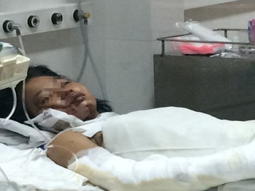 Bé gái bị mẹ tẩm xăng đốt khó giữ lại các ngón tay