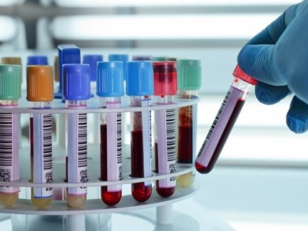 Những chỉ số sức khỏe cần biết sau 40 tuổi