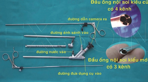 Mổ thoát vị đĩa đệm bằng phương pháp nội soi