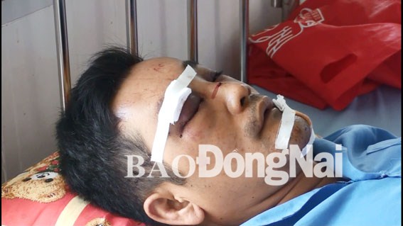 Truy xét nhóm đối tượng chém người nhập viện