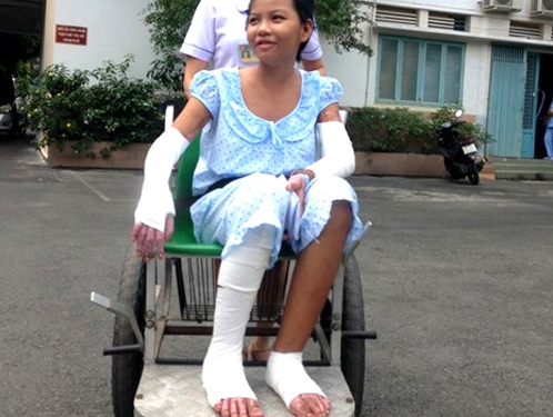 Bé gái bị mẹ tưới xăng đốt đã xuất viện