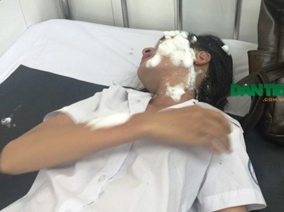 Bắt kẻ tạt axit 2 nữ sinh viên sau 5 giờ gây án