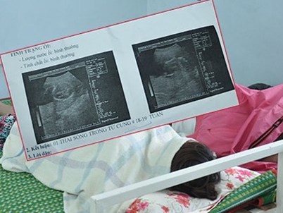 Phá thai tăng trong giới trẻ - Bài 1 Những lý do bỏ con