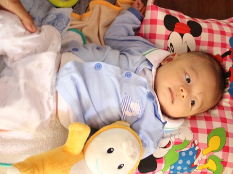 Bé 11 ngày tuổi bị đâm xuyên não mang thương tật 43