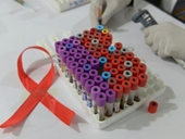 Văcxin HIV mới mang lại hy vọng cho bệnh nhân toàn cầu