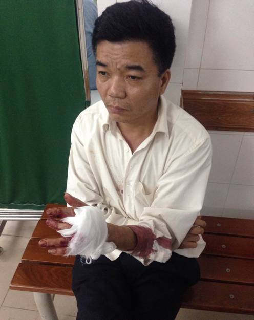 Ông Nguyễn Đoàn Bộ - nhân viên bảo vệ của Công ty Tu tạo trong tình trạng thất thần với vết thương nặng ở tay trái do ông Nguyễn Vinh Tâm chém đứt.