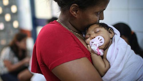  Bé Ludmilla Hadassa Dias de Vasconcelos bị tật đầu nhỏ, đang điều trị tại Bệnh viện Oswald Cruz (Recife, Brazil). Ảnh: Huffingtonpost