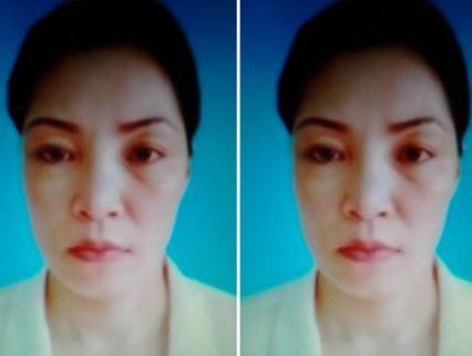 Tổng cục trưởng Kiểm tra lại tử tù dùng xi-lanh thụ tinh