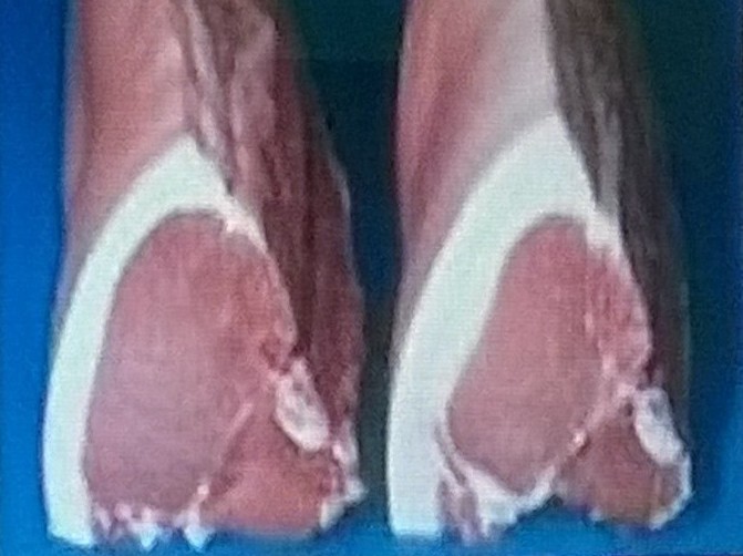 Làm sao có được thực phẩm an toàn