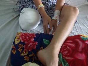 Bác sĩ kém chuyên môn, nữ sinh lớp 10 phải cưa bỏ một chân