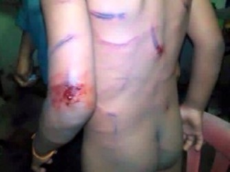 Bé trai 7 tuổi bị đánh dã man vì làm mất tiền bán vé số