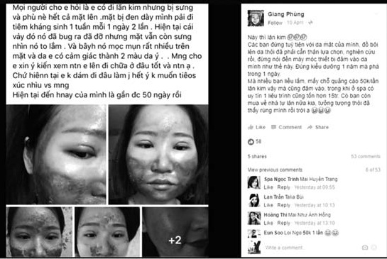 Lăn kim lên da mặt, coi chừng hối không kịp