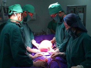 Bóc khối u xơ tử cung gần 3,6kg ra khỏi cơ thể bệnh nhân