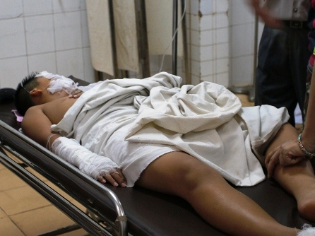 Nổ bình ga mini trong giờ thực hành nấu ăn, 5 học sinh nhập viện vì bỏng