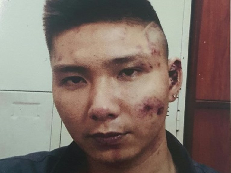 Truy sát kinh hoàng trong quán bar, hàng trăm khách hoảng loạn