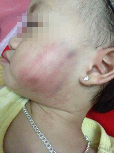 Ám ảnh vì liên tiếp các vụ bạo hành trẻ mầm non tại Hà Nội