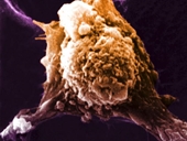 Mã hoá kháng nguyên - Đột phá mới trong nghiên cứu vắc xin ung thư