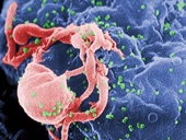 Italy và Nam Phi hợp tác nghiên cứu vắcxin điều trị HIV AIDS