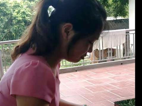 Cô giáo đạp gãy xương đùi bé trai Đạp thế nào