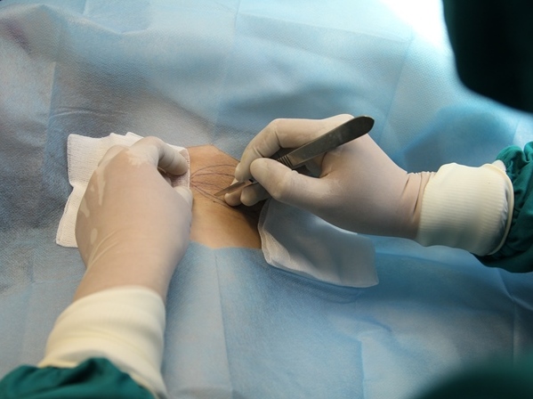 Bộ Y tế yêu cầu báo cáo ca bệnh tử vong sau mổ ruột thừa